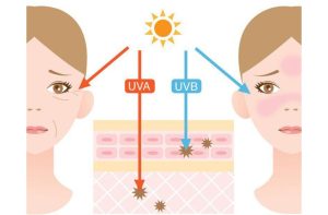 Ảnh hưởng nghiêm trọng của tia UV lên da